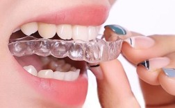 陶瓷托槽矫正牙齿效果怎样？与传统托槽有何不同？