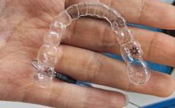 拜博口腔烤瓷牙套效果、耐用性、价格是否靠谱？适合哪些人群？