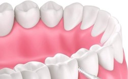 矫正牙齿牙齿清洁不到位会有哪些后果？如何正确清洁？