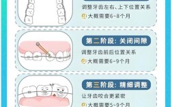 正畸 托槽 时间