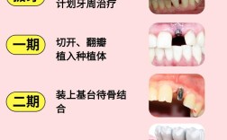 种牙过程的禁忌