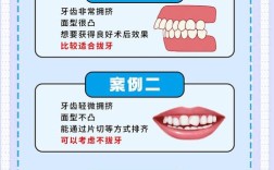 正畸推迟拔牙时间