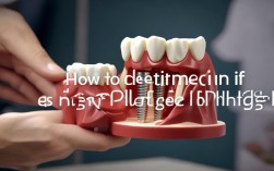 种植牙术后怎么判断是否过高？近期自查方法来了