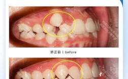 江阴矫正牙齿哪里好