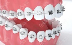 合肥矫正牙齿去哪里好？