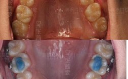 长沙哪里正畸效果好