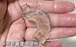 儿童天包地矫正，最佳时机是什么时候？