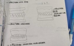 正畸安式错颌分类