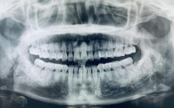 怀孕做牙齿正畸，X光检查对胎儿有影响吗？