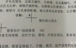 牙髓炎的诊断方法有哪些？这些关键方法你了解吗？