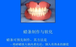 隐形义齿铸道方法