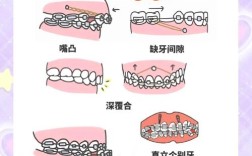 口腔正畸种植钉作为矫正辅助手段，究竟存在哪些潜在缺点？这些缺点是否会影响矫正效果或患者长期口腔健康？