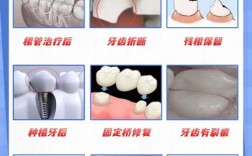 牙齿矫正好还是烤瓷牙