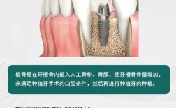 种牙植骨后疼痛一般会持续多久？不同个体恢复阶段的痛感差异大吗？