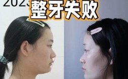 拜博 华西 正畸