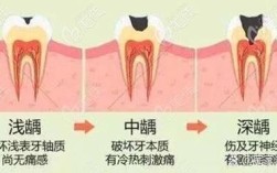 美国3m正畸保护蜡效果如何？能缓解牙套摩擦不适吗？