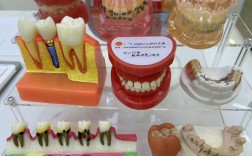 深圳种牙活动有哪些优惠？如何报名参与有保障吗？