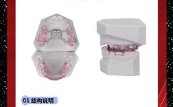 正畸sgtp双板矫治器有何独特矫治优势？