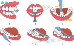 巴斯刷牙法的正确步骤是什么？