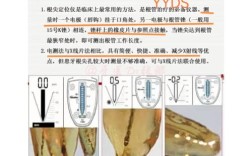 当前临床常用的根管长度测量方法有哪些？不同方法的准确性及适用场景如何选择？