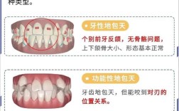 矫正牙齿咬合垫要戴多久？