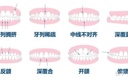 正畸近远中关系具体指什么？