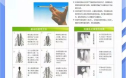 Vitapex方法在复杂根管治疗中的有效性如何？其适用范围与潜在并发症有哪些？