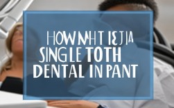 现在大牙种植牙一颗多少钱？2025年最新价多少？