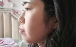 周医生正畸案例集藏着哪些牙齿矫正成功秘诀吗？