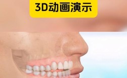 口腔正畸开合，矫正视频能解答哪些疑问？