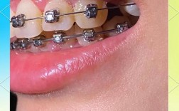 武汉矫正牙齿哪家好？专业机构怎么选？