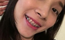 光华口腔矫正牙齿