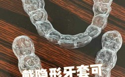 南京牙齿矫正透明牙套效果如何？值得选吗？
