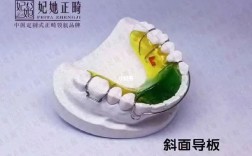 正畸斜导佩戴时间一般需要戴多久合适？