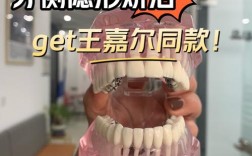 宁波隐形牙齿矫正