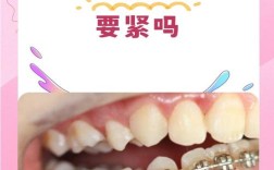 正畸拆托槽一般需要多长时间？