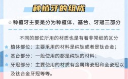 种植牙都需要哪些关键材料？