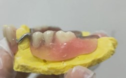 种牙时能否戴义齿？有哪些注意事项？