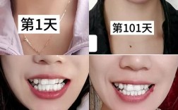 正畸牙多久能看出效果