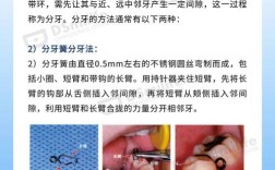 正畸分牙簧怎么上