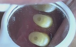 打桩和种牙是一回事吗？