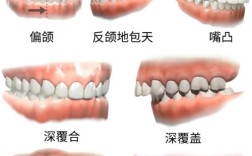 地包天牙齿矫正痛吗