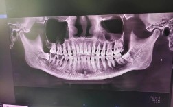 正畸影像技术平行线