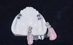 仿生美容冠矫正牙齿的效果能像真牙一样自然持久吗？