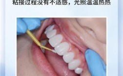 贴面修复的预备方法具体包含哪些关键步骤和注意事项？