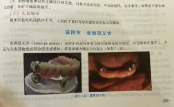 口腔用起冠器如何正确使用？步骤与方法详解