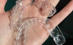 正畸保持器图片大全