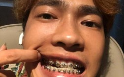 苏州牙齿矫正，如何选择靠谱机构与方案？