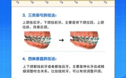 牙齿矫正橡皮链的作用到底是什么？