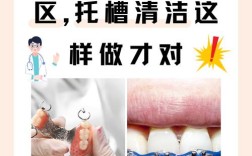 矫正牙齿前，洗牙是必须的吗？不洗会影响矫正效果吗？